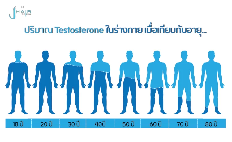 Hormone DHT สาเหตุของศีรษะล้าน - สาระน่ารู้จาก Jhair